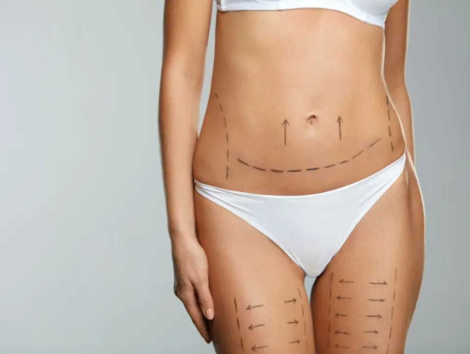 Pós-Operatório de Cirurgia Plástica