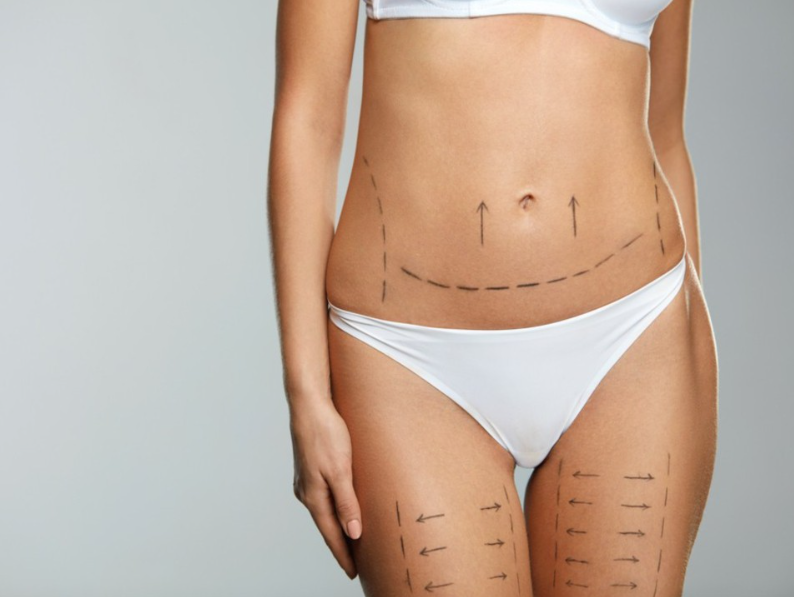 Pós-operatório de cirurgia plástica — Cairós Prime Clinic, Vila Matilde